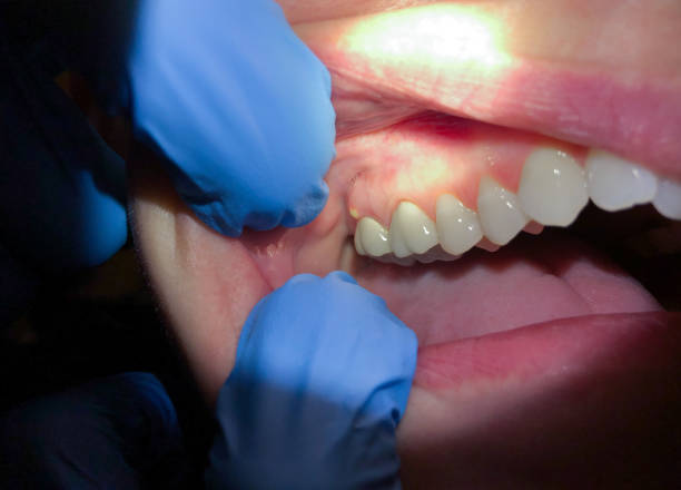 Best Urgent Tooth Repair  in New Madison, OH