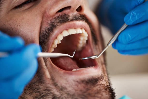 Best Emergency Dentist No Insurance  in New Madison, OH